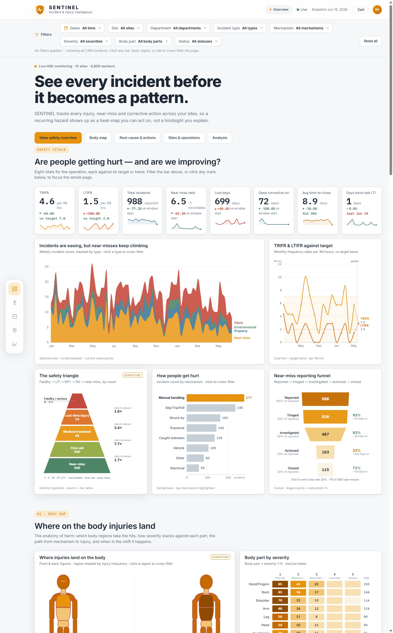 Sentinel dashboard preview